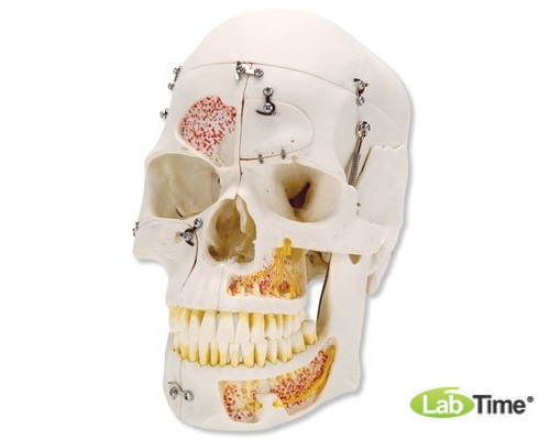 Демонстрационная модель черепа класса «люкс», 10 частей