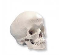Модель черепа гідроцефала