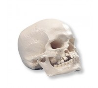 Модель черепа з «вовчою пащею» і з ущелиною в нижній щелепі