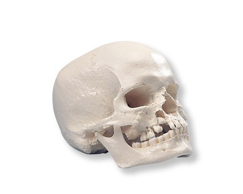 Модель черепа з «вовчою пащею» і з ущелиною в нижній щелепі