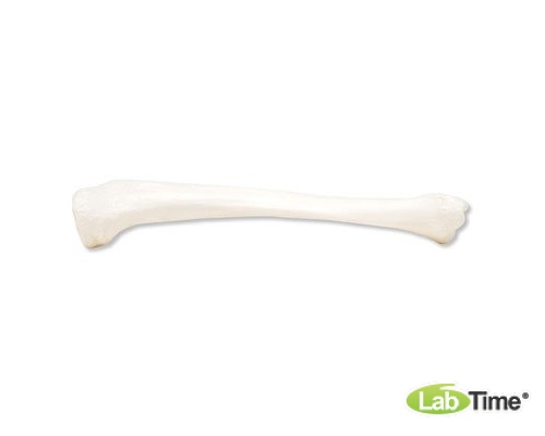 Модель левой большеберцовой кости
