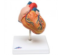 Класична модель серця з гіпертрофією лівого шлуночка, 2 частини