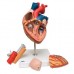 Модель серця зі стравоходом і трахеєю, 2-кратне збільшення, 5 частин
