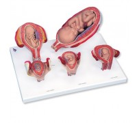 Набір з 5 моделей «Стадії вагітності» 3B Scientific®