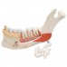 Удосконалена модель половини нижньої щелепи з 8 хворими зубами, 19 частин