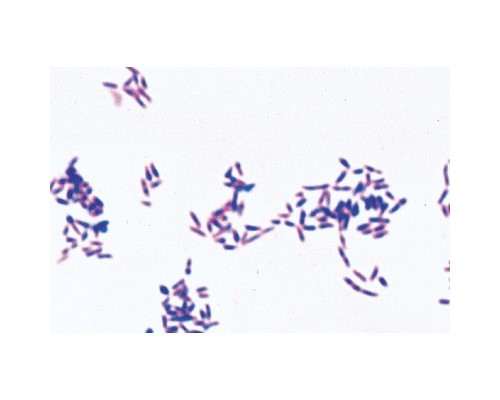Микропрепараты «Патогенные бактерии», на английском языке