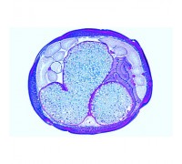 Микропрепараты «Эмбриология аскариды», на английском языке